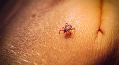 Don't Be a Victim From Ticks this Summer with medlineplus.gov and my724outdoors.com!